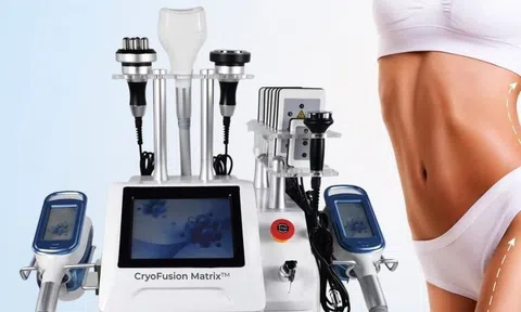 CryoFusion Matrix: Công nghệ giảm mỡ thế hệ mới hiệu quả gấp đôi xuất hiện tại Việt Nam